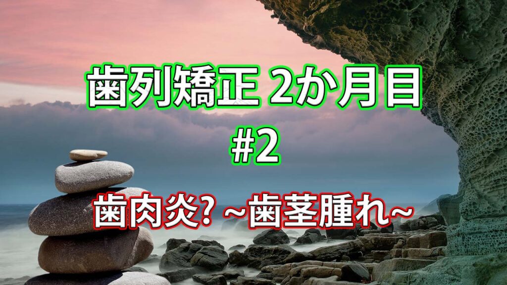 歯列矯正2か月目 #2 歯肉炎？~歯茎腫れ＆血だまり ~