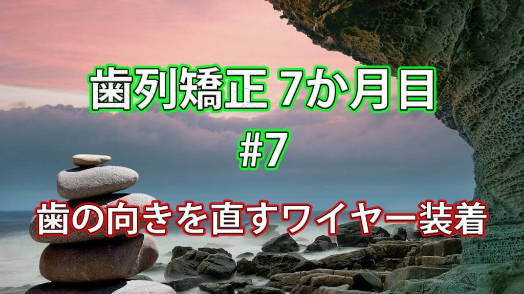 歯列矯正7か月目 #7 / 歯の角度を約70°くらい曲げるためのチェーンをつける