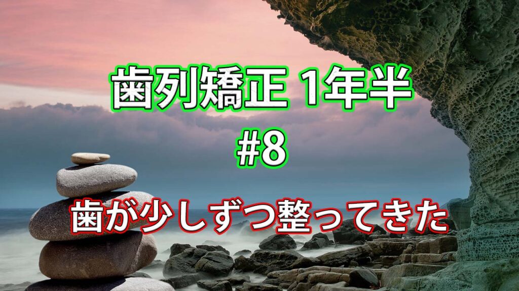 【矯正の現状報告】1年半程度が経過、少しずつ歯が整ってきた #8