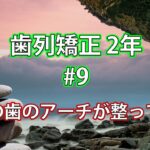 【歯列矯正2年経過】上下の歯のアーチが整ってきた #9